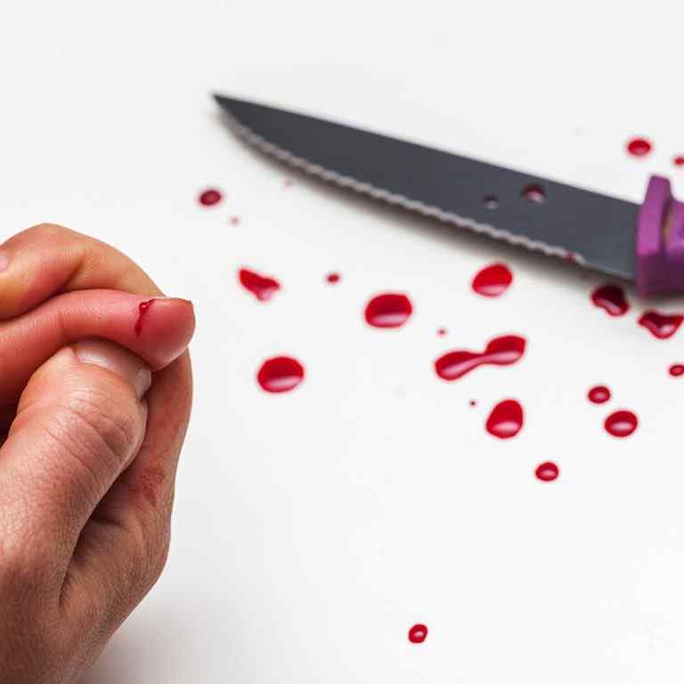 rana superficiala lipita cu super glue bison